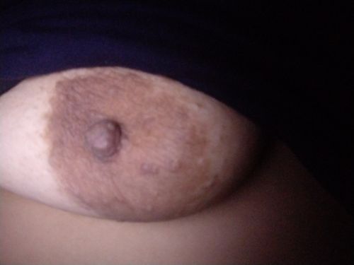 putitazorrita36